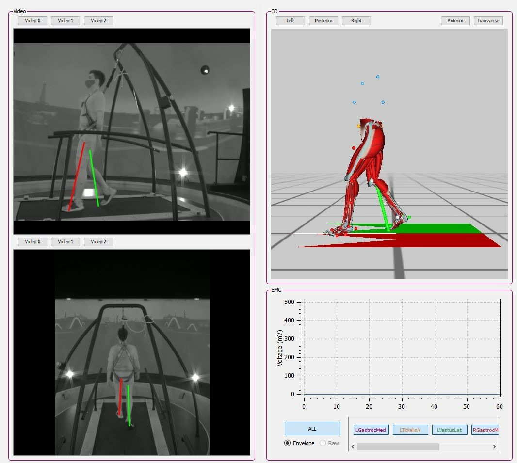 gait analysis 3